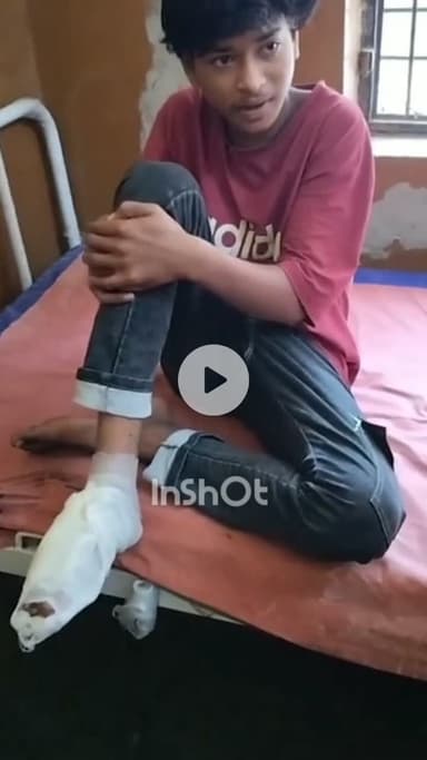 सफीपुर: सफीपुर के आसीवन में दो बाइकों की आमने-सामने भिड़ंत, किशोर सहित 2 लोग गंभीर घायल, मियागंज सीएचसी में भर्ती