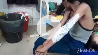 हाथरस: अलीगढ़ रोड नवग्रह मंदिर के पास एक रिसॉर्ट में कर्मचारी पर गर्म डाल मखनी गिरने से झुलसा, जिला अस्पताल में उपचार जारी