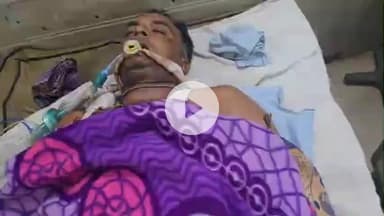 पीपलदा: अयाना थाना क्षेत्र में मोटरसाइकिल दुर्घटना में एक शख्स गंभीर रूप से घायल, एमबीएस अस्पताल में भर्ती, उपचार जारी