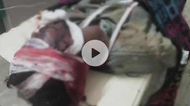 लोहरदगा: बेड़ों रोड चट्टी शक्ति पेट्रोल पंप के पास सड़क दुर्घटना, दो घायल, एक रिम्स रेफर