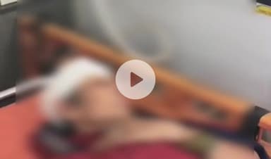 कटनी के इमलिया में बंदरों का आतंक, महिला पर हमला, ज़िला अस्पताल में भर्ती