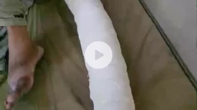 लाडपुरा: कैथूनीपोल थाना क्षेत्र में मोटरसाइकिल ने ठेला चालक को मारी टक्कर, घायल को एमबीएस अस्पताल में भर्ती किया गया