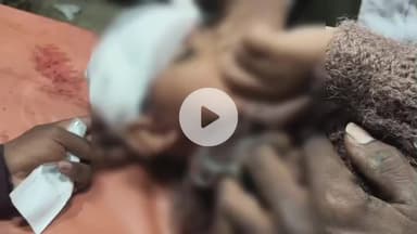 लोहरदगा: बड़ा तालाब के पास सड़क हादसे में शराबी पिता के साथ आई बच्ची घायल, बोली- अब पापा के साथ बाइक पर नहीं बैठूंगी