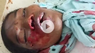 लोहरदगा: लोहरदगा-कुडु मुख्य मार्ग पर भीषण सड़क हादसे में बाइक सवार दंपत्ति की मौके पर ही मौत