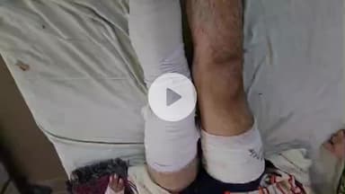 लाडपुरा: नयापुरा थाना क्षेत्र में पुरानी रंजिश के चलते युवक पर चाकू और सरियों से हमला, गंभीर घायल एमबीएस अस्पताल में भर्ती