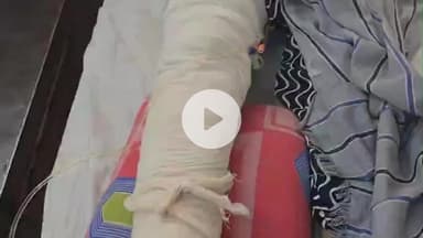 लाडपुरा: गुमानपुरा क्षेत्र के छावनी में मां को बेटी को स्कूटी सिखाना पड़ा भारी, फिसलने से महिला घायल, एमबीएस अस्पताल में भर्ती