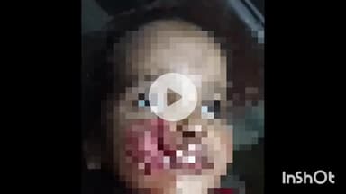 बरेली: पड़ोसी के पालतू कुत्ते ने मासूम पर किया हमला, शिकायत पर दबंगों की गुंडागर्दी से परिवार दहशत में