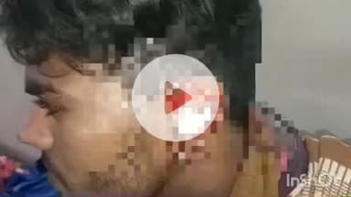 बहराइच: शिवपुरा इलाके में नशे में धुत्त युवक ने छोटे भाई के कान को दांत से काटा