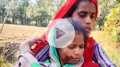 लखीमपुर: सकेथू गांव में सियार के हमले में चार ग्रामीण घायल, दहशत के बीच वन विभाग ने बढ़ाई निगरानी, तेंदुए की खबर निकली अफवाह