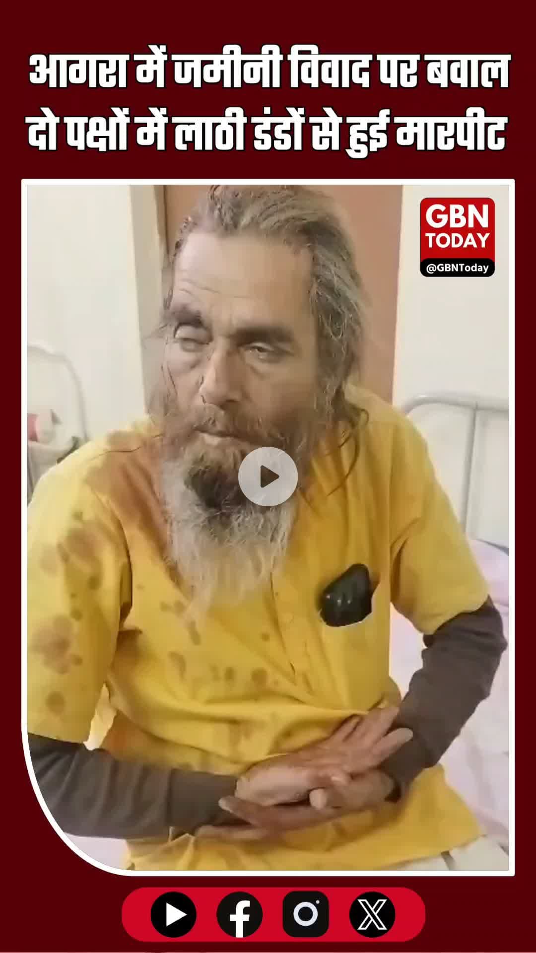 आगरा में जमीनी विवाद पर बवाल: दो पक्षों में लाठी-डंडों से मारपीट, आधा दर्जन घायल #AgraBreaking #Pinahat