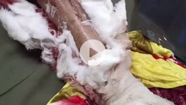 लाडपुरा: नया गांव रोड पर हादसा, ट्रैक्टर की टक्कर से बाइक सवार युवक गंभीर घायल, कोटा के MBS अस्पताल में उपचार जारी