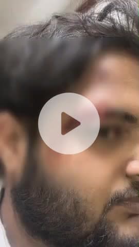 कानपुर: कल्याणपुर में लुल्ला और सपा नेता के गैंग का आतंक, छात्रनेता और उसके दोस्त पर किया जानलेवा हमला