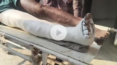 लोहरदगा: जिले में सड़क हादसों की श्रृंखला: भंडरा मार्ग, सेन्हा रोड पर 4 दुर्घटनाएं, 7 घायल