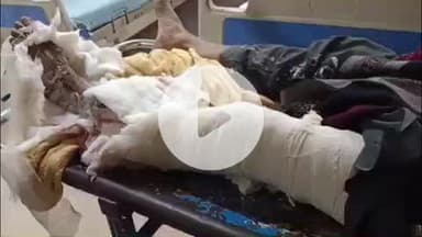 लाडपुरा: कुन्हाड़ी थाना क्षेत्र के बालिता रोड़ पर शराब के पैसे नहीं देने पर पुत्र ने पिता पर कुल्हाड़ी से किया जानलेवा हमला