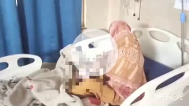 बहराइच: किसुनपुर मीठा गांव में खौलती कढ़ाई में गिरने से बालक झुलसा, हालत गंभीर, इलाज जारी