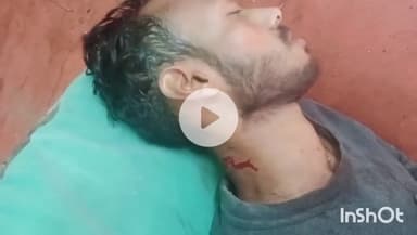 हरदोई: शहर के पीताम्बर गंज में युवक पर चाकू से हमला, गंभीर हालत में जिला अस्पताल में भर्ती, पुलिस जांच में जुटी