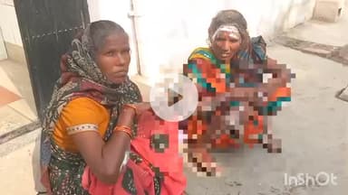 हरदोई: इटौली गांव में चूल्हे पर खाना बनाते समय पास में रखे सिलेंडर में लगी आग से महिला झुलसी, बचाने आई बहन भी झुलसी