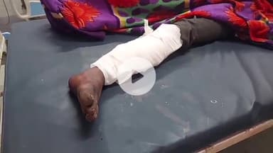 डिंडौरी: बजाग में अज्ञात कार ने युवक को टक्कर मारी, युवक गंभीर रूप से घायल, ज़िला अस्पताल में इलाज जारी