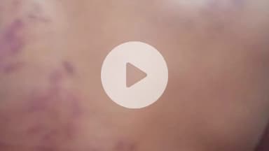 भोरे: सिसई गांव में युवक को कमरे में बंद कर मारपीट, जातिसूचक गाली देने का आरोप, पुलिस ने मामला दर्ज कर शुरू की जांच