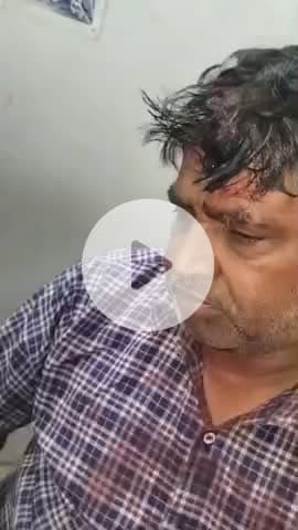 भुसावर: पथैना में एक ही परिवार के दो पक्षों में खेत में सिंचाई के पानी को लेकर हुआ विवाद, पिता-पुत्र हुए घायल