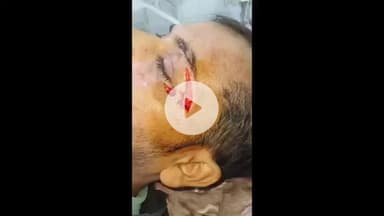 हमीरपुर: सुमेरपुर में पुलिस ने शिकायत पर कार्रवाई नहीं की, जिसके बाद हुआ हमला