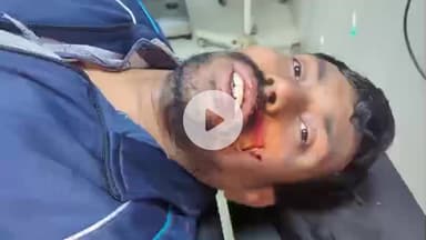 आरा: सदर अस्पताल में ज़ख्मियों का इलाज कराया गया, जानकारी के अनुसार ये विक्रम थाना क्षेत्र, पटना के निवासी हैं