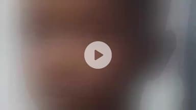 पटना ग्रामीण: राजीव नगर में 25 वर्षीय महिला की ईंट से कुचलकर हत्या, पुलिस कर रही है जाँच