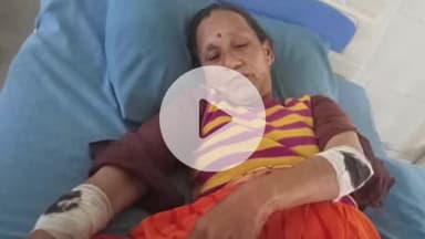 पूर्णागिरि: आमबाग में गौशाला में पशुओं को चारा देने गई महिला पर जंगली सूअर ने किया हमला, घायल का यूपी जिला अस्पताल में चल रहा इलाज