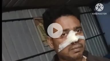 नवादा: नवादा जिले के पकरीबरावां में युवक का मारपीट के दौरान तलवार से नाक काटने का आरोप, वीडियो तेजी से हो रहा वायरल