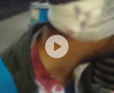 बिल्हौर: बिल्हौर रेलवे स्टेशन पर वृंदावन जा रहे युवक पर बदमाशों ने मोबाइल लूटने की नीयत से किया हमला