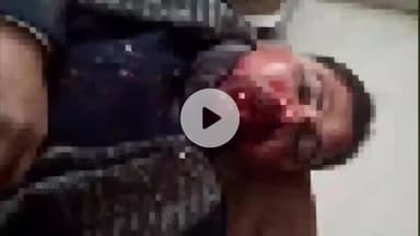 जहानाबाद: रतनी में टेंपो पलटने से दांत के डॉक्टर गंभीर रूप से घायल, सदर अस्पताल में भर्ती