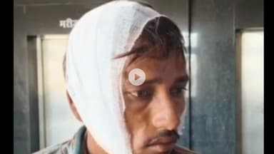 शिवपुरी: करमाज खुर्द गांव में दो भाइयों से मारपीट, एक के सिर में आई चोट, सिरसौद पुलिस ने मामला दर्ज किया