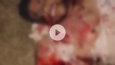 डग: डग के समीप नेशनल हाईवे पर ट्रैक्टर और कार की भिड़ंत, 2 की मौत, 3 गंभीर घायल