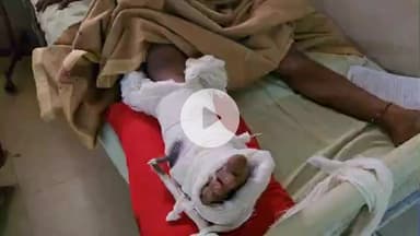 लाडपुरा: गुमानपुरा थाना इलाके के छावनी में 2 मोटरसाइकिलों की टक्कर में एक युवक घायल, एमबीएस अस्पताल में भर्ती