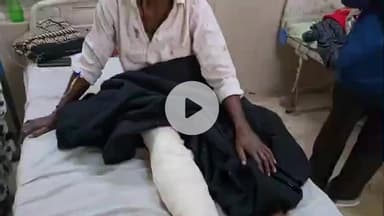 लाडपुरा: नगर निगम के ठेका कर्मचारी की मोटरसाइकिल ने एरोड्रम चौराहे पर मारी टक्कर, गंभीर घायल एमबीएस अस्पताल में भर्ती