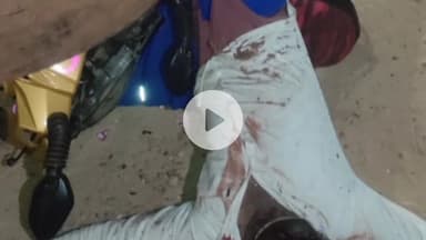 ಸಂಡೂರು: ಬಂಡ್ರಿ ಗ್ರಾಮ ಬಳಿ ನಿಂತಿದ್ದ ಲಾರಿಗೆ ಬೈಕ್ ಡಿಕ್ಕಿ: ಸ್ಥಳದಲ್ಲೇ ಸವಾರ ಸಾವು