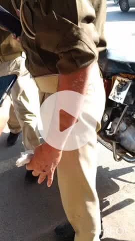 जसराना: टूंडला चौराहे पर ऑटो चालक ने पुलिसकर्मी को मारा कट, पुलिसकर्मी हुए चोटिल