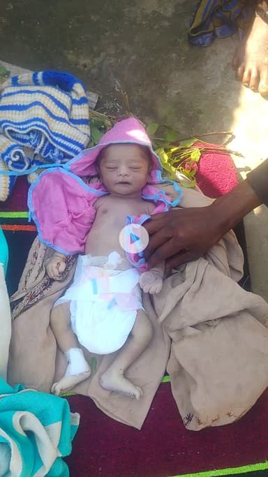 jald se jald karwahi ki jaay please mai ek baap apne bache ko esi halat Mai laya hu  aasha karyakarta #babita# bhumiya