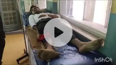 बांदा: शहर के बिजली खेड़ा मोहल्ले में चलती बाइक में युवक को जहरीले सांप ने काटा, युवक की हालत बिगड़ी