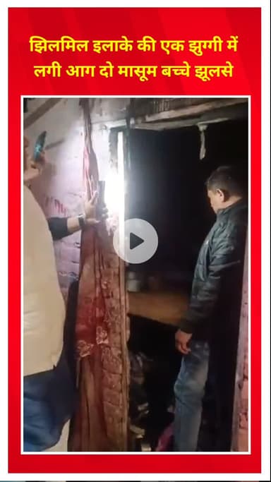 शाहदरा: झिलमिल इलाके की झुग्गी में आग, दो मासूम बच्चे झुलसे