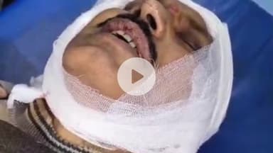 सागर नगर: मंडी के पास दिनदहाड़े 14 लाख की लूट, एक आरोपी गिरफ्तार, दो की तलाश जारी