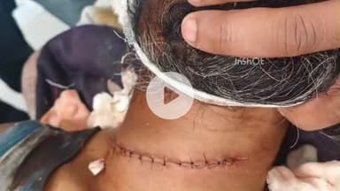 संग्रामपूर: नायलॉन मांजाने युवकाचा गळा चिरला..