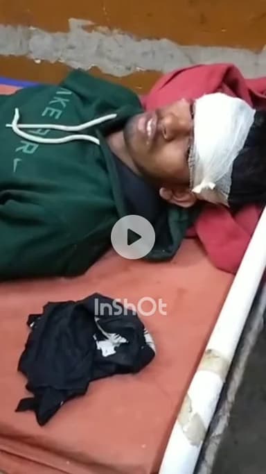 सफीपुर: सफीपुर क्षेत्र में लखनऊ-बांगरमऊ मार्ग पर बाइक पलटी, पिता-पुत्र गंभीर घायल, कुत्ते से टकराकर हुआ हादसा