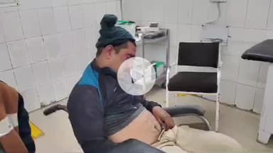 इटावा: सिविल लाइन इलाके में सड़क दुर्घटना में घायल हुए सिपाही को पुलिस ने इलाज के लिए अस्पताल पहुंचाया, इलाज जारी है