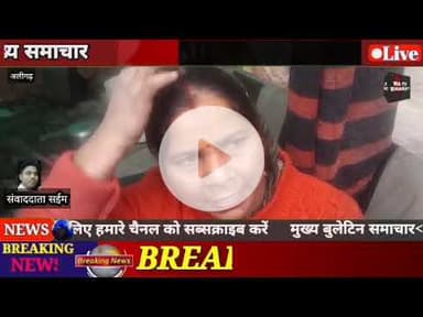 #अलीगढ़ के थाना बन्ना देवी के क्षेत्र सर्वोद नगर में दिनदहाड़े बाप और बेटे को मारी गोली आपको बता दें