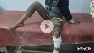 सासाराम: सासाराम के चौखंडी पथ पर पागल कुत्ते ने लगभग 15 लोगों को काटकर किया घायल