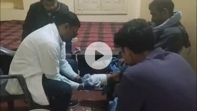 कोडरमा: अग्रसेन भवन में कृत्रिम अंग प्रतिरोपण शिविर के अंतिम दिन 30 दिव्यांगजन लाभान्वित हुए