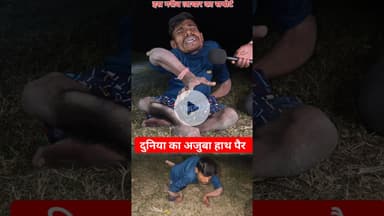 दुनिया का अजूबा आदमी हाथ पैर देखिये!! #shorts #divyang #ajuba #trend #handmade #viralvideo #reels