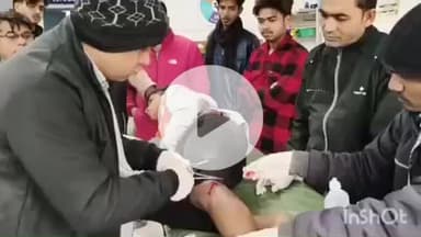 भभुआ: भभुआ वार्ड 23 में बदमाशों ने एक किशोर को मारपीट कर चाकू से किया घायल, इलाज जारी