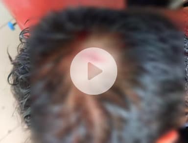 कानपुर: शातिर लुल्ला पुलिस के लिए बनी बड़ी चुनौती, कोहना में किया जानलेवा हमला, युवक के सिर पर आई गहरी चोट